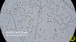 Image result for Podoscypha multizonata