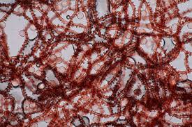 Attēlu rezultāti vaicājumam “Arcyria denudata spores”