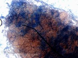 Attēlu rezultāti vaicājumam “Stemonitopsis hyperopta var. landewaldii”