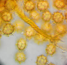 Attēlu rezultāti vaicājumam “Trichiaceae, Hemitrichiaceae, Arcyriaceae”