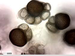 Attēlu rezultāti vaicājumam “Urocystis anemones spores”