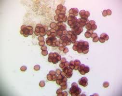 Attēlu rezultāti vaicājumam “Badhamia flavoglauca”