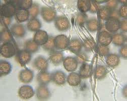 Attēlu rezultāti vaicājumam “Didymium annulisporum”