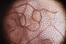 Attēlu rezultāti vaicājumam “Arcyria affinis capillitium”