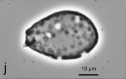 Attēlu rezultāti vaicājumam “Milesina murariae”