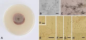 Attēlu rezultāti vaicājumam “Badhamia juliae spores”