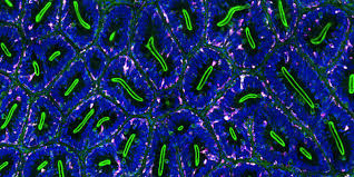 Attēlu rezultāti vaicājumam “Cribraria purpurea macro”