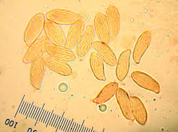 Attēlu rezultāti vaicājumam “Reticularia jurana spores”