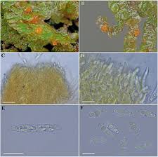 Attēlu rezultāti vaicājumam “Octosporella jungermanniarum”
