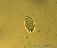 Attēlu rezultāti vaicājumam “Disciotis venosa”