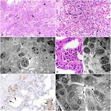 Attēlu rezultāti vaicājumam “Erinaceus sp.”