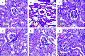 Attēlu rezultāti vaicājumam “Lachnum corticale”