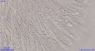 Attēlu rezultāti vaicājumam “Ombrophila violacea spores”