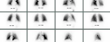 Image result for  v    q