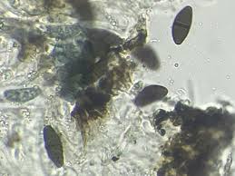 Attēlu rezultāti vaicājumam “Arthonia leucopellaea”