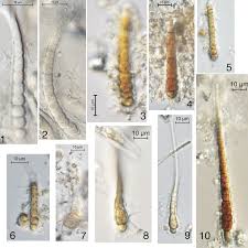 Attēlu rezultāti vaicājumam “Heterotrichia insignis (syn. Arcyria insignis) macro”