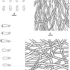 Attēlu rezultāti vaicājumam “Postia rennyi”