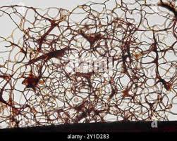 Attēlu rezultāti vaicājumam “Stemonitis splendens spores”