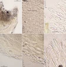 Attēlu rezultāti vaicājumam “Hymenoscyphus calyculus”