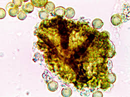 Attēlu rezultāti vaicājumam “Lindbladia tubulina macro”