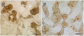 Attēlu rezultāti vaicājumam “Lycogala miserum”
