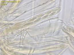 Attēlu rezultāti vaicājumam “Cudoniella acicularis”