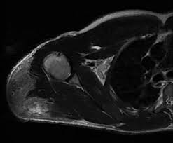 Image result for SYNTHOL