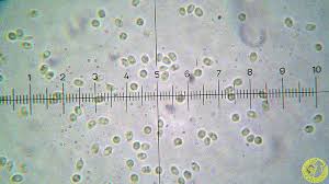 Attēlu rezultāti vaicājumam “Antrodiella semisupina”