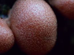 Attēlu rezultāti vaicājumam “Lycogala exiguum aggr. young”