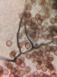 Attēlu rezultāti vaicājumam “Physarum, Nannengaella sp.”