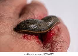 Attēlu rezultāti vaicājumam “Hirudinea”