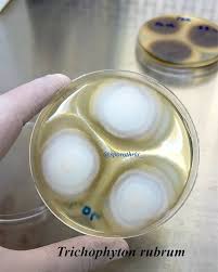 Attēlu rezultāti vaicājumam “Blepharostoma trichophyllum sporophyte”