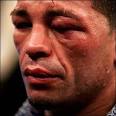 after a fight
