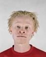 They sometimes have blond hair and blue eyes, not the white hair and pink