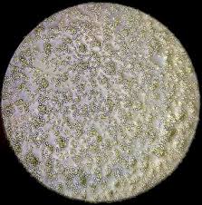 Attēlu rezultāti vaicājumam “Badhamia versicolor spores”