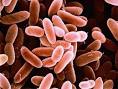 Listeria Photos and Images - ABC News