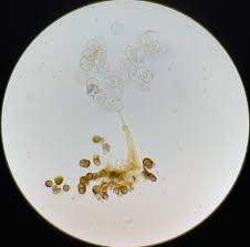 Attēlu rezultāti vaicājumam “Physarum bryomacrocarpum spores”