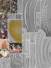 Attēlu rezultāti vaicājumam “Orbilia sp.”