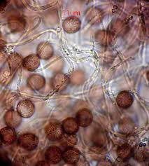 Attēlu rezultāti vaicājumam “Diderma effusum macro”