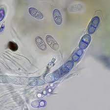 Attēlu rezultāti vaicājumam “Acrocordia gemmata”