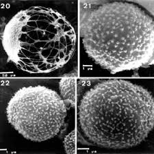 Attēlu rezultāti vaicājumam “Cribraria intricata spores”