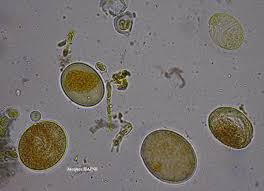 Attēlu rezultāti vaicājumam “Trichia contorta spores”