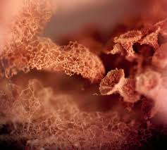 Attēlu rezultāti vaicājumam “Heterotrichia oerstedii (syn. Arcyria oerstedii) spores”