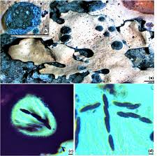 Attēlu rezultāti vaicājumam “Hypotrachyna sp.”