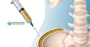 Image result for BMAC