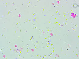 Attēlu rezultāti vaicājumam “Athelia pyriformis”