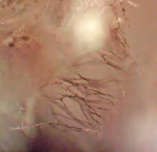 Attēlu rezultāti vaicājumam “Didymium aggregatum”