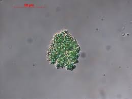 Attēlu rezultāti vaicājumam “Gloeocapsa rupestris”