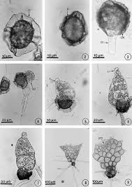 Attēlu rezultāti vaicājumam “Gulielmina vermicularis spores”