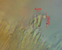 Attēlu rezultāti vaicājumam “Octospora splachnophila spores”